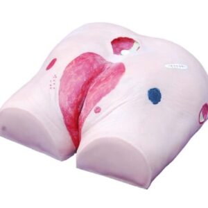 Ulcer Care Model