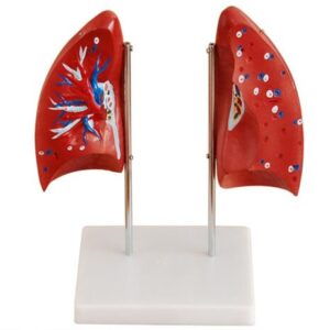 Lung Model