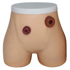 Ostomy Nursing Model