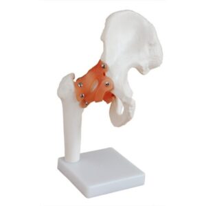 XC-110 Life-Size Hip Joint