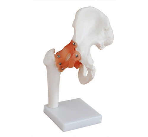 XC-110 Life-Size Hip Joint