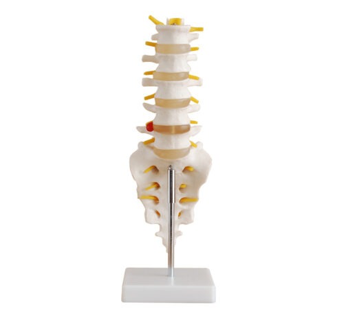 XC-119 Life-Size Lumbar Vertebrae with Sacrum & Coccyx and Herniated Disc