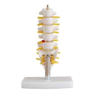 XC-119A Mini Lumbar Vertebrae with Sacrum & Coccyx and Herniated Disc