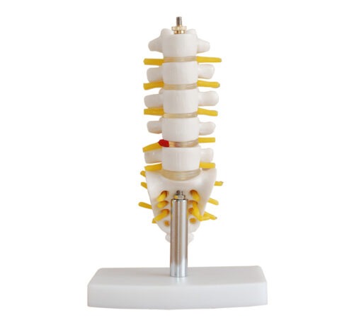XC-119A Mini Lumbar Vertebrae with Sacrum & Coccyx and Herniated Disc