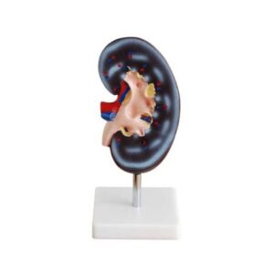 XC-310-1 Kidney Model (1 Part)