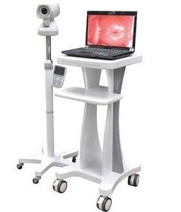 colposcope